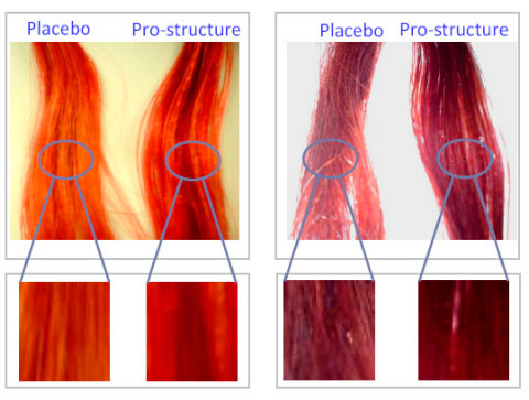Pro-Structure